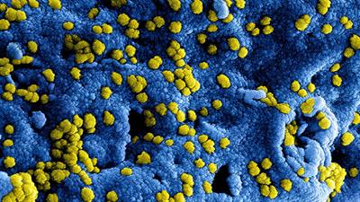 Afbeelding Coronavirus: hoe gaan wij hiermee om?